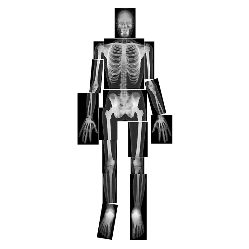 True To Life Human X-Rays - Human Anatomy - Roylco Inc.