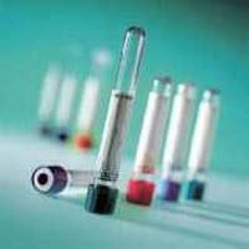 BD Medical Vacutainer Tube 5Ml 13 X 100Mm Gold Sst, Case of 10 | ShelHealth