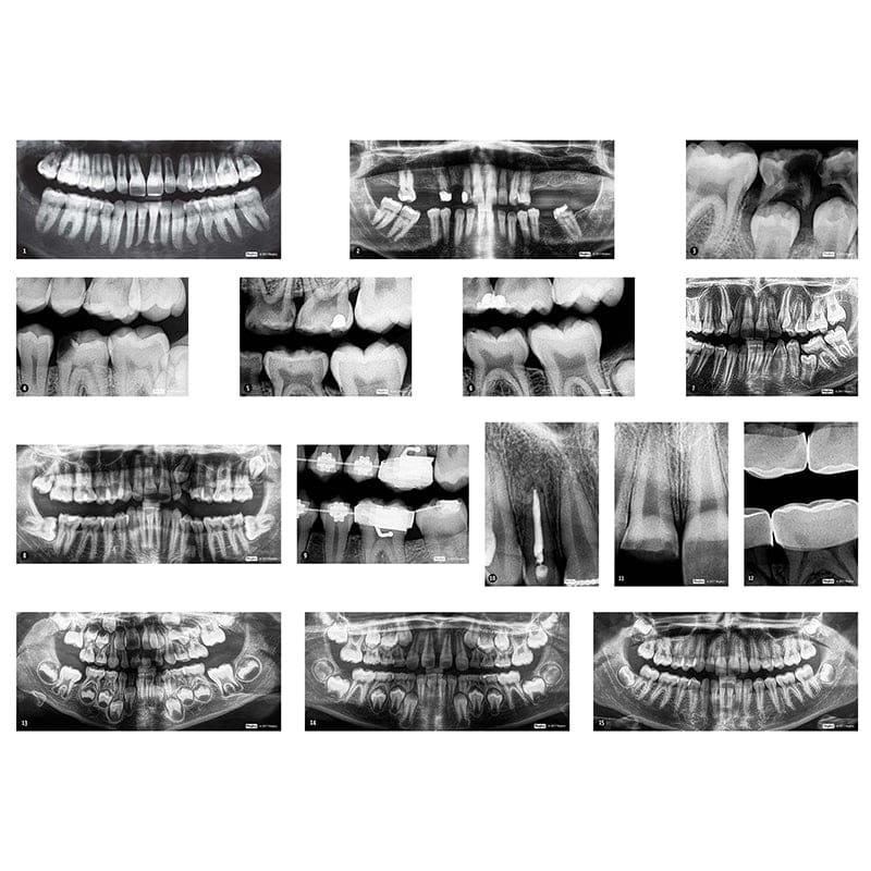 Dental Xrays - Human Anatomy - Roylco Inc.