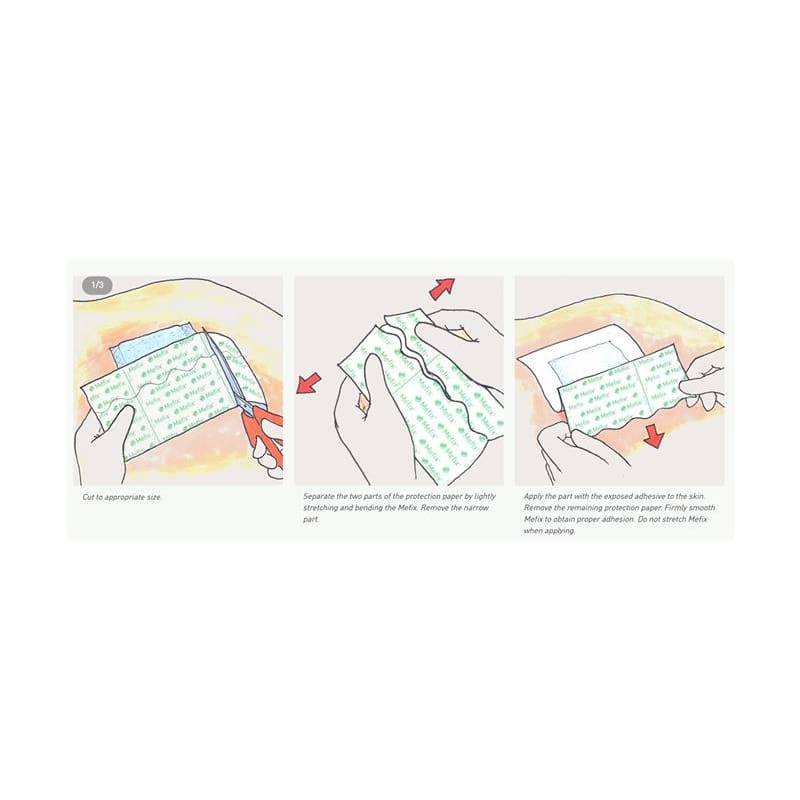 Molnlycke Mefix Fabric Tape 2In X 11Yds (Pack of 3) - Wound Care >> Basic Wound Care >> Tapes - Molnlycke